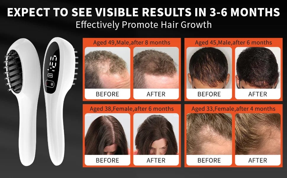 Electric Laser Hair Growth Comb  /  Anti Hair Loss /  Therapy Comb / Infrared  /  650nm 470nm LED Red Light /  Vibration Massage /  Hair Care Brush  /  Portable